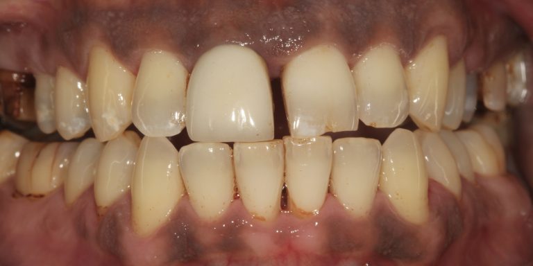 Stain Removal 1 After copy 2