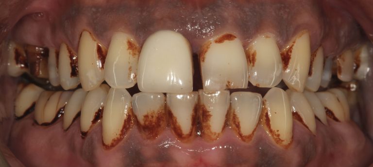 Stain Removal 1 Before copy 2
