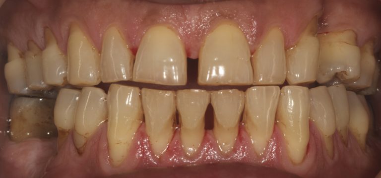 Stain Removal 2 After copy 2