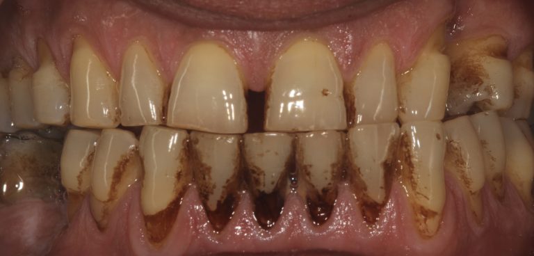 Stain Removal 2 Before copy 2