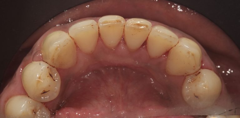 Stain Removal 3 After copy 2