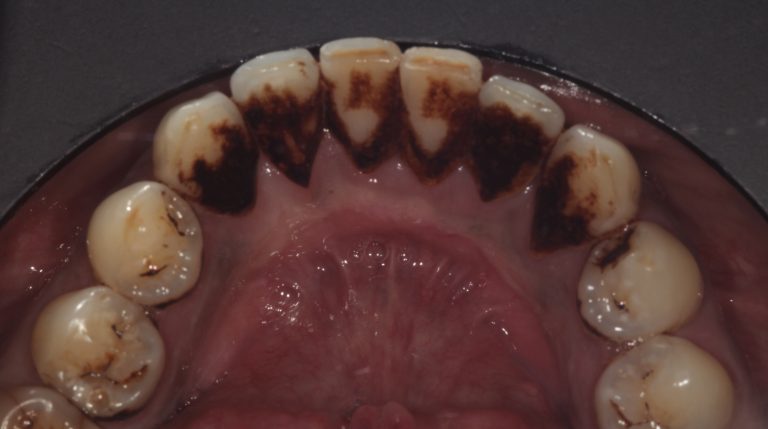 Stain Removal 3 Before copy 2